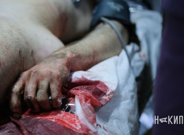 Стабілізаційний пункт, стабпункт, Вовчанський напрямок, медики, лікарі, лікарня, поранені військові, поранення, Фото: Ігор Лептуга