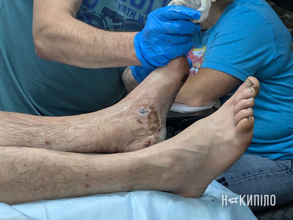 Стабілізаційний пункт, стабпункт, Вовчанський напрямок, медики, лікарі, лікарня, поранені військові, поранення, Фото: Ігор Лептуга