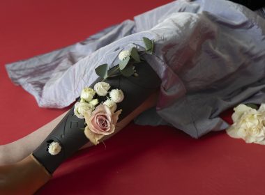 На фотографії дівчина позує із косметичною накладкою на протез. Накладка чорного кольору із вишиваним орнаментом, прикрашена живими квітами