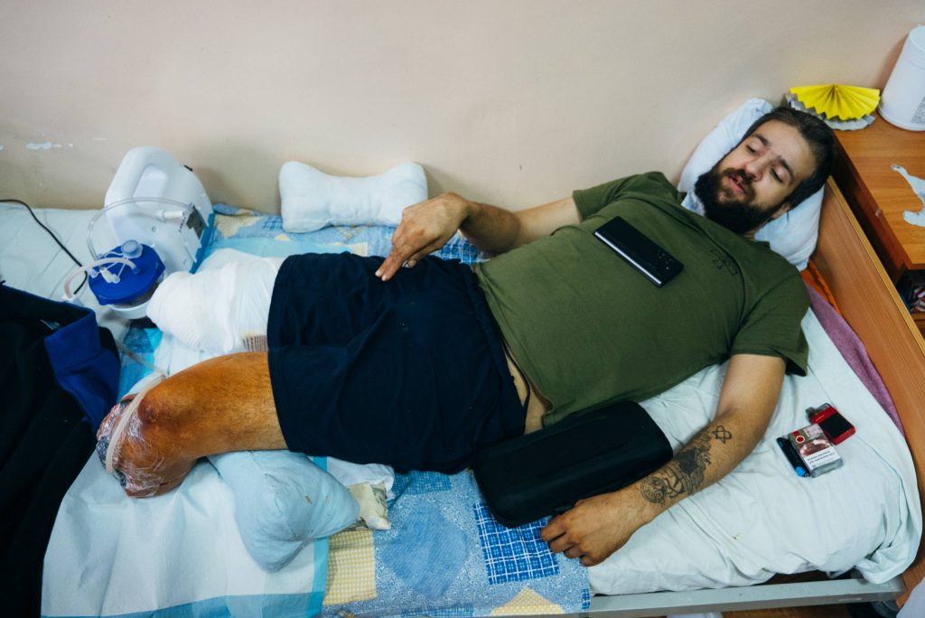 Протезування та реабілітація військових в Україні 3 Владислав, військовослужбовець