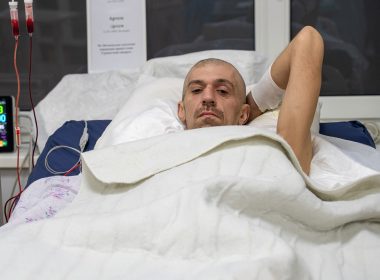 Артем, провів 42 доби з турнікетом